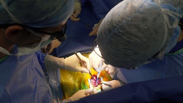 Chirurgen bei Herz-OP | Bild: BR