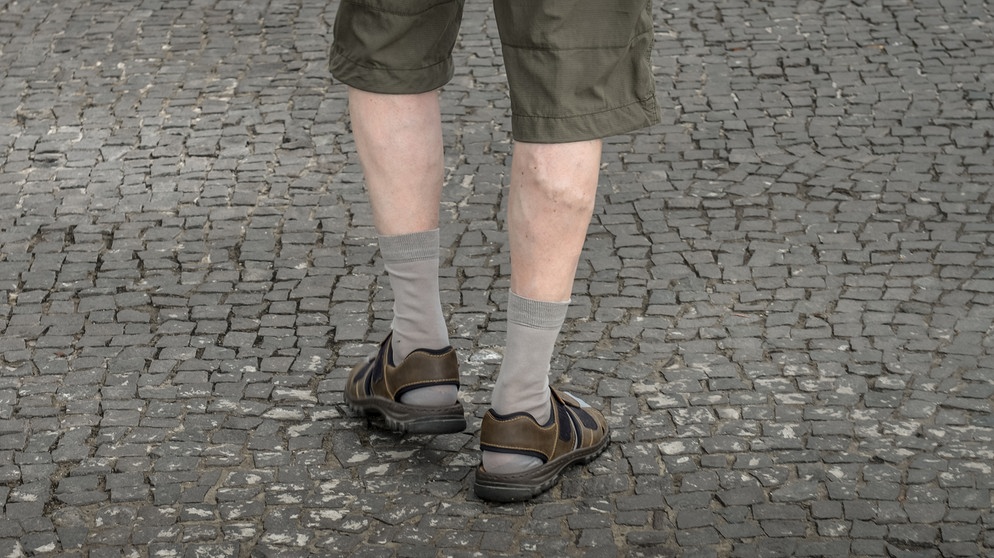 Ein Mann mit einer Krampfader am Bein | Bild: picture-alliance/dpa