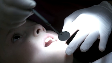 Kind mit Kreidezähnen beim Zahnarzt | Bild: Screenshot BR