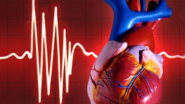 Medizinisches Herz-Modell vor EKG-Kurve | Bild: BR