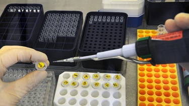 Labortest auf der Suche nach einem Impfstoff | Bild: picture-alliance/dpa
