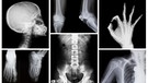 Zusammenstellung verschiedener Röntgenbilder des menschlichen Körpers. | Bild: colourbox.com