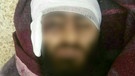 Angeblich die Leiche von Erhan A.; der Salafist aus dem Allgäu soll in Syrien getötet worden sein. | Bild: Facebook