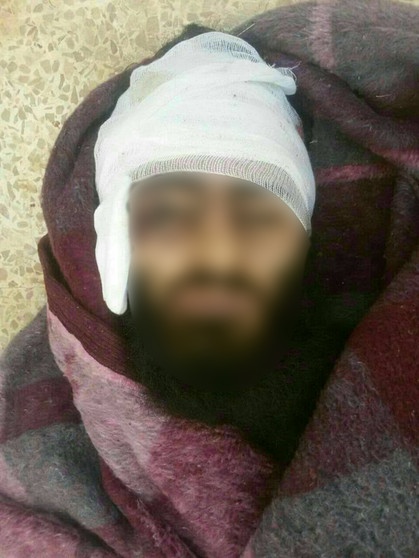 Angeblich die Leiche von Erhan A.; der Salafist aus dem Allgäu soll in Syrien getötet worden sein. | Bild: Facebook