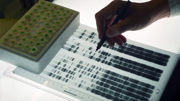 Untersuchung genetischer Fingerabdrücke, z.B. zur Abstammungsbegutachtung.  | Bild: dpa-Zentralbild