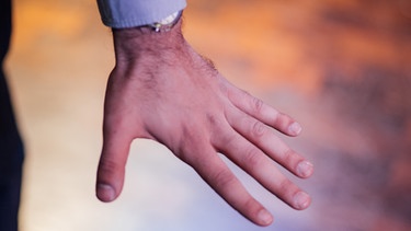 Christian Alts Hand - vom Chip unter der Haut nichts zu erkennen | Bild: BR