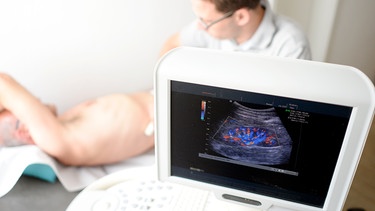 Ein Arzt untersucht die Nieren eines Patienten mittels Ultraschall. | Bild: picture-alliance/dpa