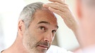 Mann betrachtet im Spiegel kritisch seinen Haaransatz | Bild: colourbox.com