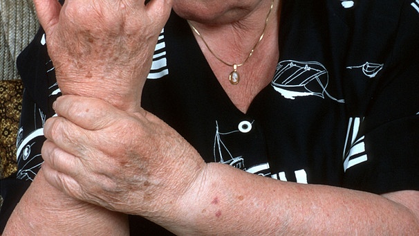 Frau hält sich arthritisches Handgelenk | Bild: picture-alliance/dpa