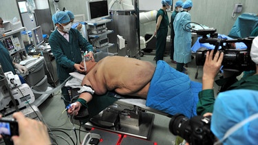 Fettleibiger Mann bekommt Magenverkleinerung | Bild: picture-alliance/dpa