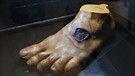 Original-Abformungen einer Pestpustel (Hand) und einer Pestnekrose (Fuß | Bild: picture-alliance/dpa
