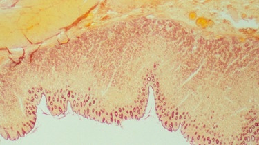 Mikroskopische Übersicht eines Magen | Bild: picture-alliance/dpa