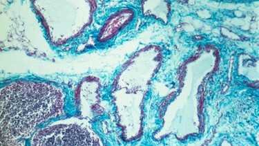 Große Lymphgefäße unter dem Mikroskop | Bild: picture-alliance/dpa