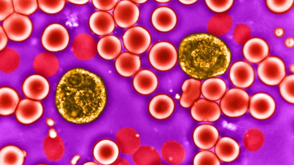 Rote und weiße Blutzellen unter dem Lichtmikroskop | Bild: mauritius-images
