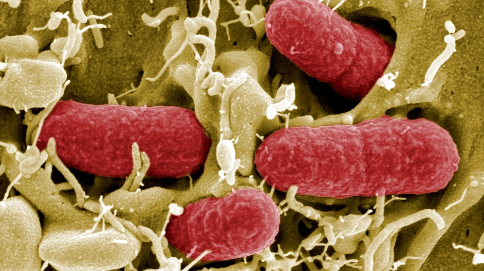 Zu Wenig Coli Bakterien Im Darm