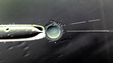80- bis 100-fache Vergrößerung der Befruchtung einer Eizelle mit einer Injektionspipette | Bild: picture-alliance/dpa