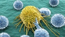 Krebszelle und Lymphozyten | Bild: Fotolia - Juan Gärtner