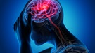 Illustration Gleichgewichtsstörung im Gehirns. | Bild: stock.adobe.com/peterschreiber.media