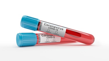 Illustation von zwei auf Coronavirus getesteten Blutentnahmeröhrchen vor weißem Hintergrund.  | Bild: stock.adobe.com/marog-pixcells