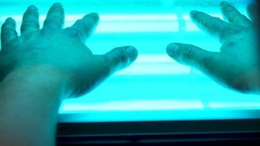 Handekzem - eine der häufigsten Hautkrankheiten: Eine Behandlung mit UV-A-Strahlung kann helfen. | Bild: Screenshot BR