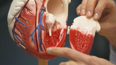 Herz-Modell aus Plastik | Bild: BR