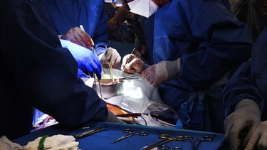 07.01.2022, USA, Baltimore: Ärzte operieren an einem Schweineherz das in einen menschlichen Patienten eingesetzt wird. Ein Transplantationsteam in den USA hat nach eigenen Angaben erstmals ein genetisch modifiziertes Schweineherz an einen menschlichen Patienten angeschlossen. Das Organ sei einem 57-jährigen Mann mit einer lebensgefährlichen Herzkrankheit am Freitag in einer Klinik in Baltimore (Maryland) eingesetzt worden. Foto: Tom Jemski/University of Maryland School of Medicine/dpa +++ dpa-Bildfunk +++ | Bild: dpa-Bildfunk/Tom Jemski