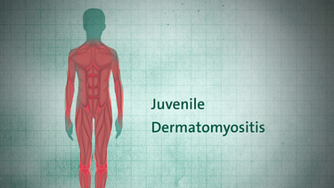 Juvenile Dermatomyositis | Bild: BR 