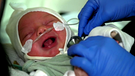 Baby mit RS-Virus: Kinderkliniken am Limit | Bild: BR