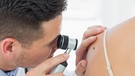 Ein Dermatologe untersucht ein Muttermal auf der Haut einer Patientin. | Bild: stock.adobe.com/WavebreakmediaMicro