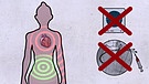 Grafik zu Gefahr durch falsche Diagnostik in der Medizin | Bild: BR/Gut zu wissen
