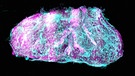 Blick ins Gewebe einer Niere mit einem Laser-Scanner-Mikroskop | Bild: Helmholtz Zentrum München / Ertürk Lab