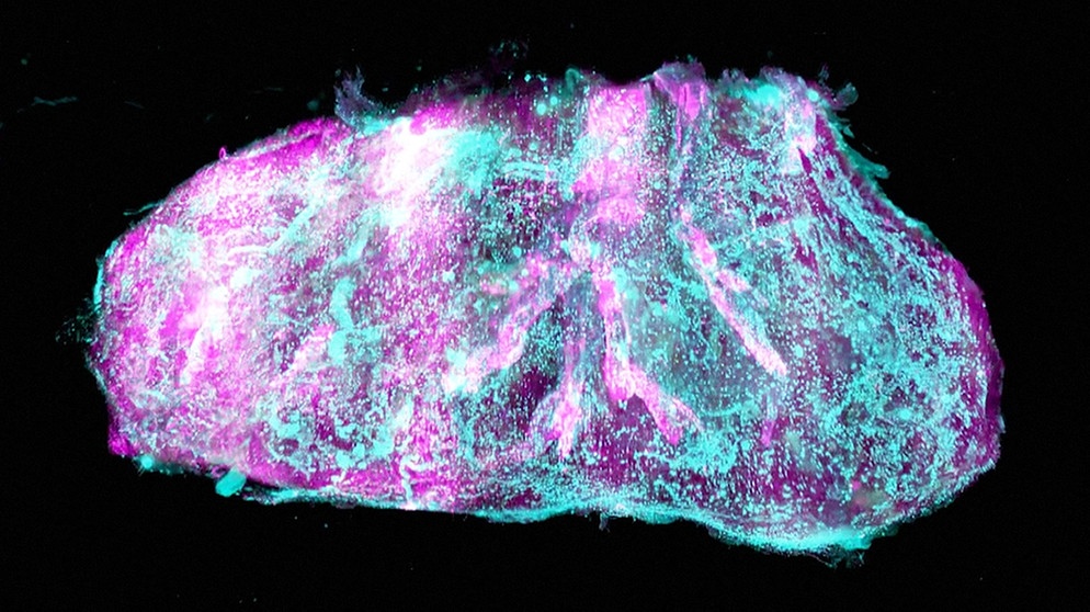 Blick ins Gewebe einer Niere mit einem Laser-Scanner-Mikroskop | Bild: Helmholtz Zentrum München / Ertürk Lab