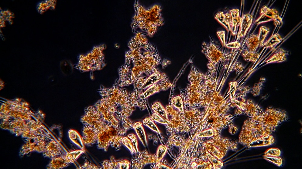 Mikroskopaufnahme: Mikroorganismen machen sauber und fressen den Schmutz | Bild: BR/Gut zu wissen 