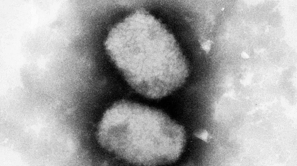 29.06.2001, Berlin: Diese vom Robert Koch-Institut (RKI) zur Verfügung gestellte elektronenmikroskopische Aufnahme zeigt das Affenpockenvirus. Erstmals ist auch in Deutschland ein Fall von Affenpocken nachgewiesen worden.  | Bild: dpa-Bildfunk/Andrea Männel