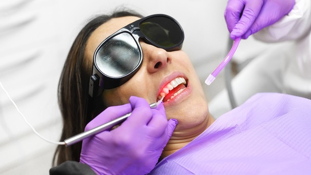 Laserbehandlung beim Zahnarzt | Bild: picture-alliance/dpa/ Zoonar  David Herraez Calzada