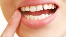 Frau mit schmerzhafter Zahnfleischentzündung im Mund hält Finger an Zahn | Bild: picture alliance / Zoonar | Robert Kneschke