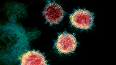 Diese undatierte elektronenmikroskopische Aufnahme, die von den U.S. National Institutes of Health im Februar 2020 zur Verfügung gestellt wurde, zeigt das Virus, das Covid-19 verursacht.  | Bild: dpa-Bildfunk/Uncredited