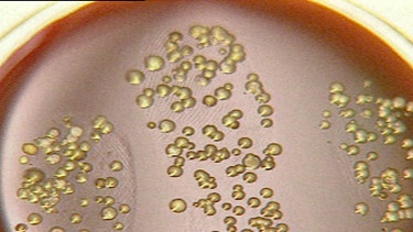 Bakterien wachsen in einer Petrischale | Bild: BR