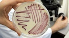 Petrischale mit MRSA-Keimen (Methicillin-resistenten Staphylococcus aureus) | Bild: picture-alliance/dpa