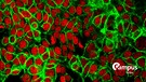 Forscher im Midwest Cancer Nanotechnology Training Center (M-CNTC) haben neue Medikamente für die Krebstherapie entwickelt. Das Bild zeigt, wie Mikropartikel des Medikamentes sich an den noch kleineren Mikrofasern der Krebszellen festsetzen.
Human colon cancer cells with cell nuclei stained red and E-cadherin protein stained green.
| Bild: picture alliance / BSIP | NIH / IMAGE POINT FR