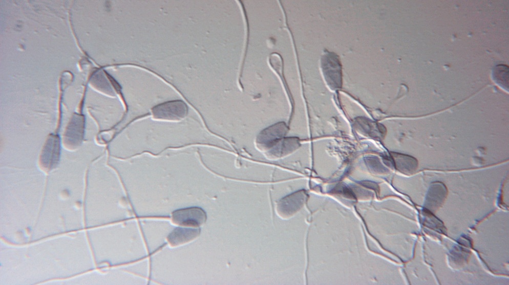 Medizin Gynäkologie Fortpflanzung Spermien Mikroaufnahme Vergrößerung 630:1 Lichtmikroskop medicine gynaecology sperm sperm1-630xdic | Bild: picture-alliance / OKAPIA KG, Germany | Dr.Gary Gaugler/OKAPIA