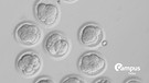 Stammzellen | Bild: picture-alliance/dpa