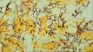 Bakterium Treponema Pallidum | Bild: BR; Interaktion