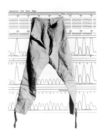 Unterhose von Kaspar Hauser vor DNA-Testergebnissen (Fotomontage) | Bild: picture-alliance/dpa