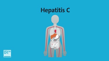 #fragBR24 Was ist Hepatitis C? | Bild: Bayerischer Rundfunk