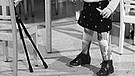 Kind mit Kinderlähmung | Bild: Bayerischer Rundfunk