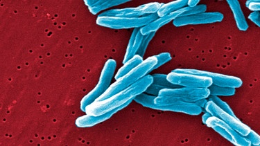 Die starke Vergrößerung des "Mycobacterium Tuberculosis" unter dem Elektronenmikroskop.  | Bild: picture alliance / BSIP | CDC