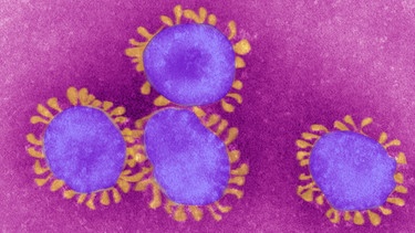 Das Coronavirus unter dem Mikroskop | Bild: picture-alliance/dpa