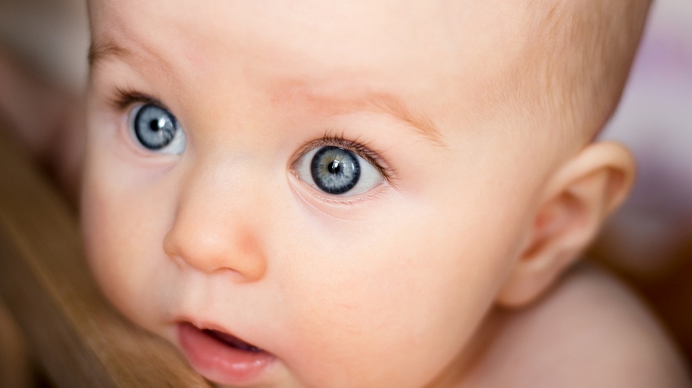 Unterschiedlich große augen baby unterschiedlich grosse