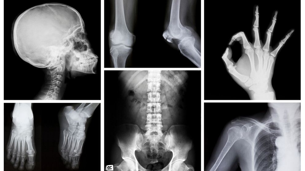 Zusammenstellung verschiedener Röntgenbilder des menschlichen Körpers. | Bild: colourbox.com